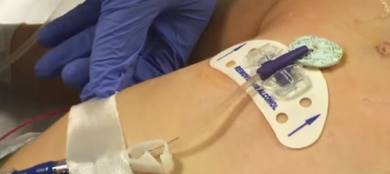 Accesso venoso nel bambino e nel neonato